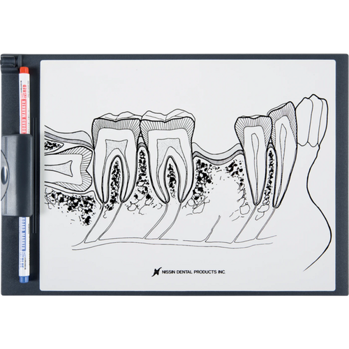 Demonstrasjonsbord posterior region P13-TR200 stk.