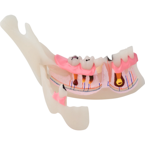 Patologisk halv UK modell P13-TR10 stk.