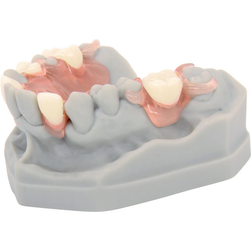 dentona vivapink Set 900 g powder, 660 ml liquid