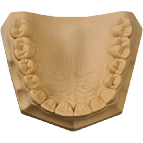 UltiRock Carton 15 kg plaster golden brown