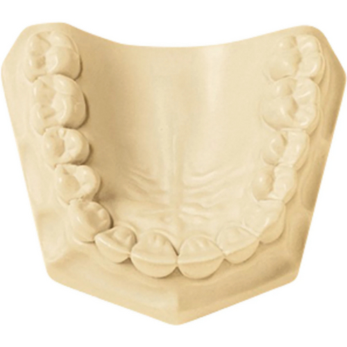 UltiRock Carton 15 kg plaster ivory