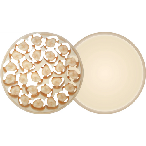 AMBARINO High-Class Piece H 15 mm, A2-MC