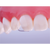 CoForms matriser 8 stk 22D