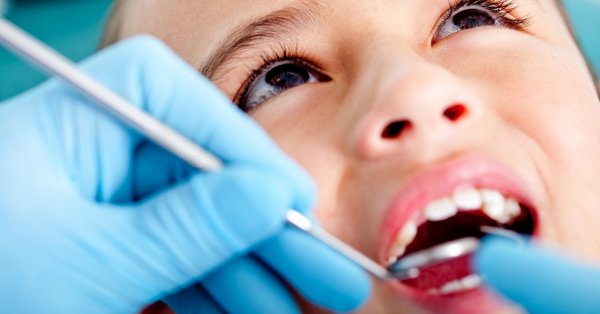 Why Moms Don't Talk About Cavities