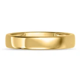 Photo of Ignaz Classic Wedding Band Set 14K Yellow Gold [BT2269YM]