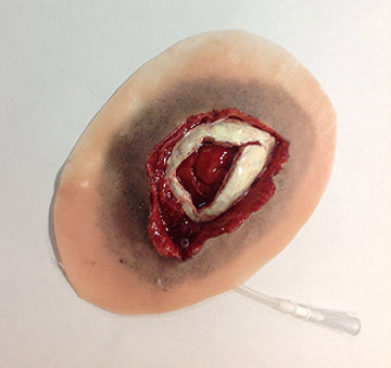 Open Skull Fracture, 800-609