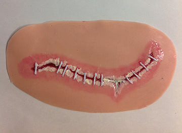 Surgical Site Infection Level2, 800-658