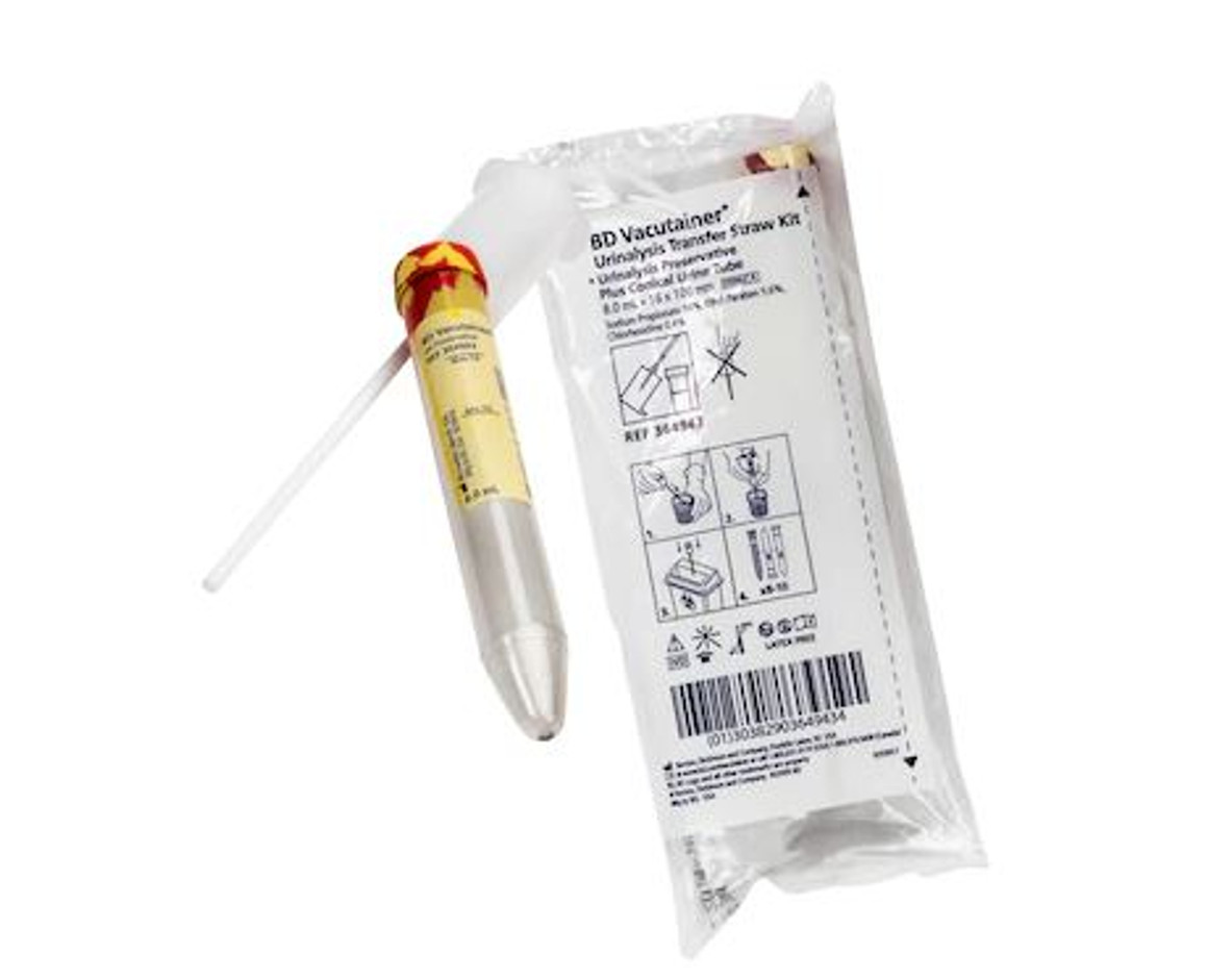 Transfer straw and plus plastic conical tube with preservative for urinalysis