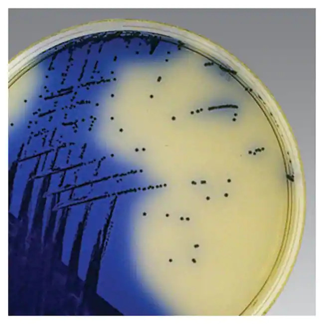 Thermo Scientific™ Oxoid™ ORSAB Selective Supplement