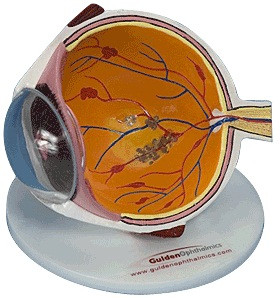 GoodLite Vision Threatening Disease Eye Model Medex Supply