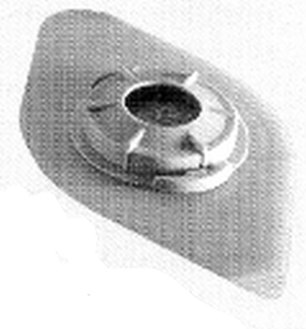 Luminaud TrachNaze Baseplate, Small, 10/pk Medex Supply