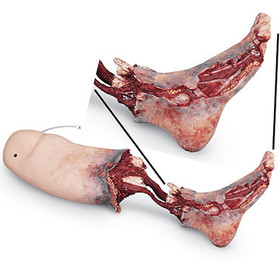 Smart Stat Xtreme Trauma Bleeding Leg, 101-482