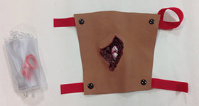 Compound Fracture Humerus - Dark, 800-6816B