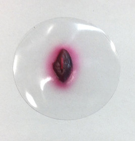 Exit Small Wound, 800-733