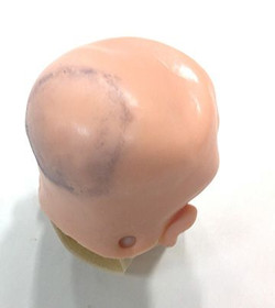 Simulaids Subgaleal Hemorrhage Wound, 800-881