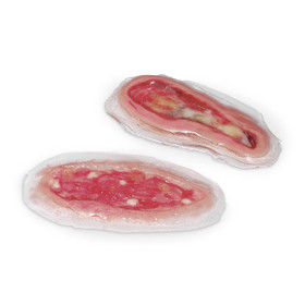 Life/Form Wound - Dihiscence, LF00736