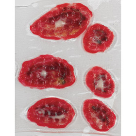 Life/Form Venous Stasis Ulcer, LF00792