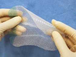 Self-Fixating Hernia Repair Mesh ProGrip Partially Absorbable Knitted Polyester Monofilament / Polylactic Acid (PLA) 10 X 15 cm Anatomical Flat Style Undyed Sterile