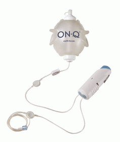 ON-Q* C-bloc Intl Pain Relief System with ONDEMAND*, 400 ml x 5 ml/hr + 5 ml PCA/60 min, CBI003