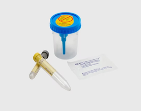 Vacutainer Urine Collection Kit 8mL/4mL Plastic Sterile