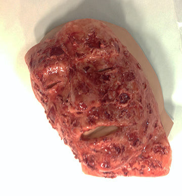 Burned Face, 800-613