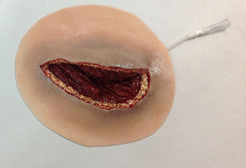 Major Muscle Laceration, 800-616