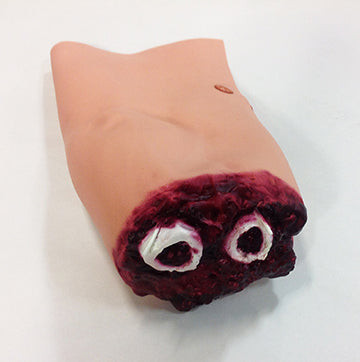 Lower Arm Amputation, 800-623