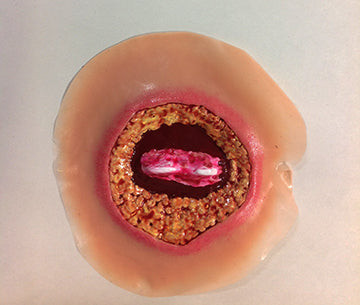 Bed Sore 4th Stage 70 mm, 800-660