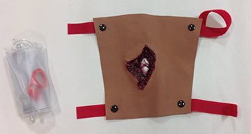 Compound Fracture Humerus - Dark, 800-6816B