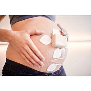 Avalon beltless fetal monitoring solution, 866488