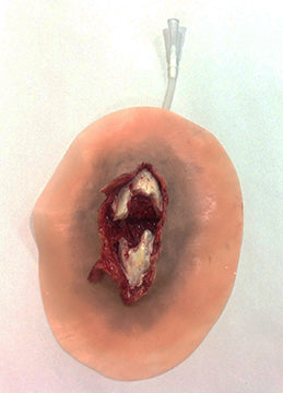 Xtreme Open Fracture Tibia, 800-011