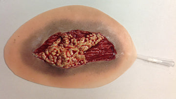 Skin Laceration, 800-614