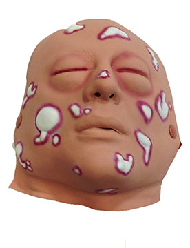 Mustard Gas Moulage, 800-625