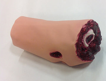 Leg Amputation - Light, 800-6760