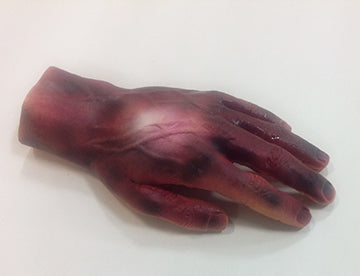 Burn Hand 2nd & 3rd Degree, 800-6799