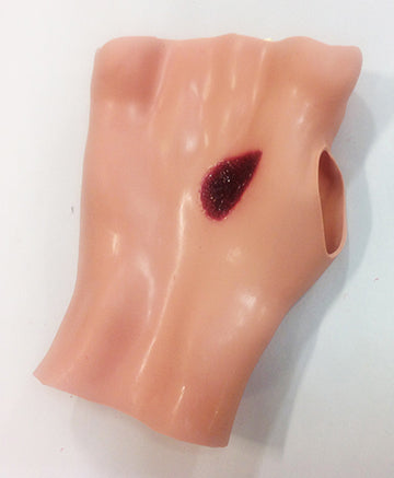 Phosphorous Burn Hand, 800-6801