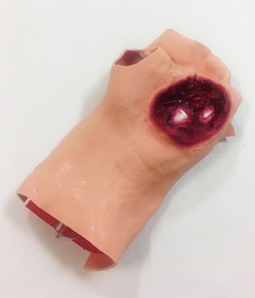 Gunshot Wound Palm, 800-6881