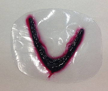 Blunt Bat Wound, 800-728