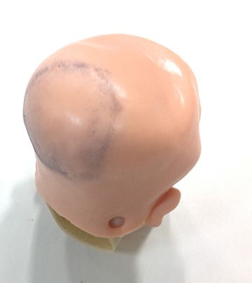 Simulaids Subgaleal Hemorrhage Wound, 800-881