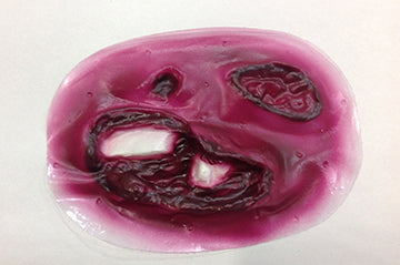 Compound Fracture Tibia Stick-On, 800-906