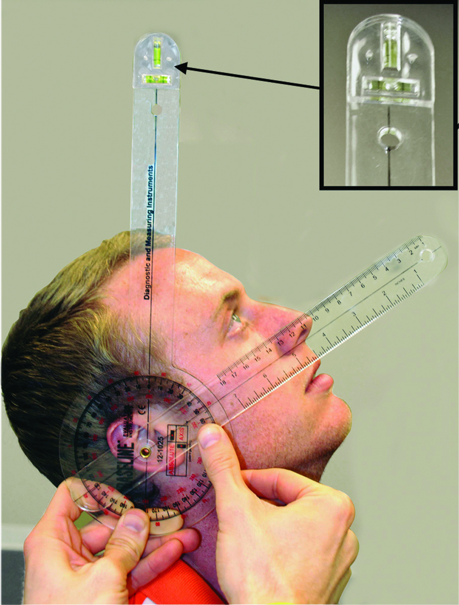 Baseline Plastic Absoluteaxis Goniometer Hires 360 Degree Head 12 Inch Arms 25 Pack 5688