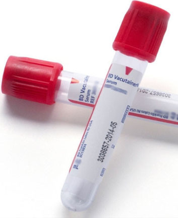 BD Vacutainer Blood Collection Tube with Hemoguard, 5mL, 100/bx