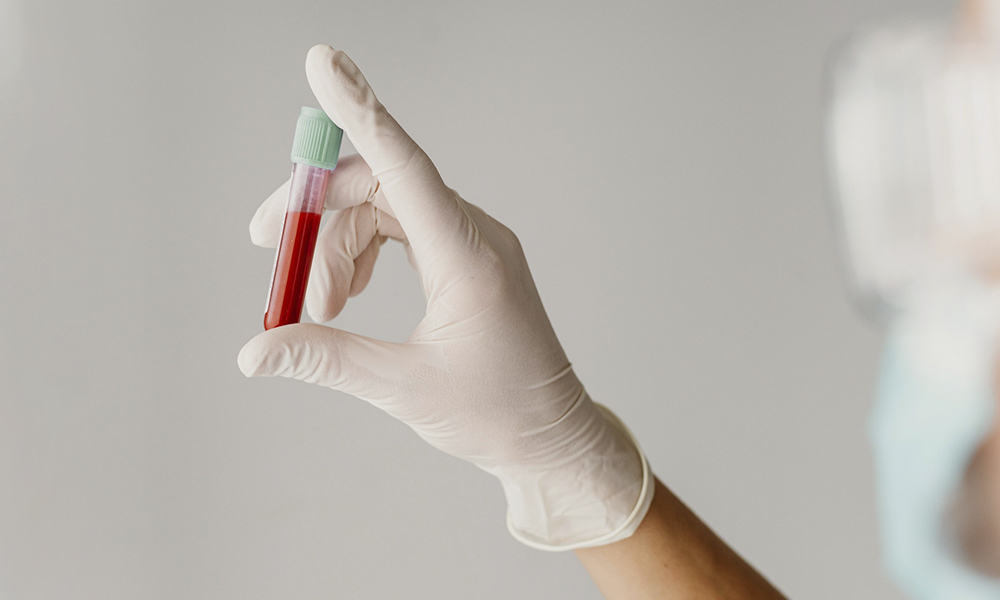 Test de vitamina D en Farmacia Fra, en A Coruña