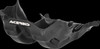 Acerbis 05062142