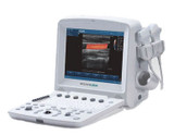 Revolutionizing Healthcare: A Deep Dive into Ultrasound Systems and Equipment