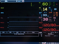 Edan Diagnostic Equipment: Reliable Monitoring Solutions for Clinics, Hospitals & Veterinary Care | EMRN