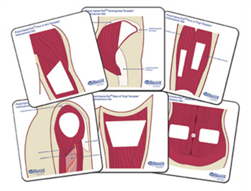 The Practi-Mini Templates anatomically simulates the location and landmarks for the most commonly used injection sites. Each 5" x 5" anatomical template overlays the surface area of the Practi-Mini Injecta Pad allowing for quick visualization and realistic needle placement. Students in nursing, pharmacy, EMT, medical corps, and medical assisting programs can practice countless needle stick injections independently.