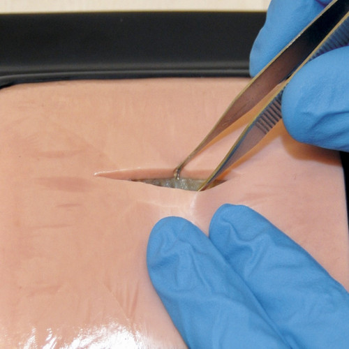 This 5 in. x 6 in. slab of skin with a top dermis layer and fat tissue underneath is ideal for suturing, stapling, and various plastic surgery skills training. Reusable. Long shelf life - no refrigeration required. Nontoxic, latex-free, and not oily. Comes packed in water in a resealable pouch to keep product moist. Durable Skin Base is highly recommended (SB48845U, sold separately).