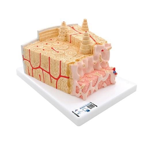 This extremely detailed bone structure model depicts a three-dimensional section of a lamellar bone, showing a typical structure of a tubular bone enlarged 80 times. The bone structure model shows various planes in cross and longitudinal section through all levels of the bone, as well as a 2-plane section through the inner structure of the bone marrow. The typical elements of a lamellar bone are easily identified in this bone structure model and help to understand its structure and function with the characteristic osteons, also referred to as Haversian systems. This bone structure model allows a graphic illustration of the interplay of the individual components, such as spongy and compact substance, endosteum, cortical substance, osteocytes, Volkmann and Haversian canals. 3B MICROanatomy™ Bone structure supplied on base. There is no better way to teach and learn about the structure of the human bone then with this great Microanatomy bone model!