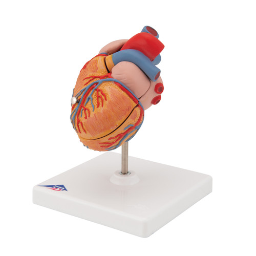 This unique heart model shows the long-term effects of increased heart activity due to high blood pressure. The muscular wall of the left heart ventricle is considerably thickened and the tip of the heart is visibly rounded off. Highly detailed 2-part heart at a price you will love. The front heart wall is detachable to reveal the chambers and valves inside. The heart is just slightly smaller than life-size with exquisite anatomical detail throughout. Heart on removable stand.